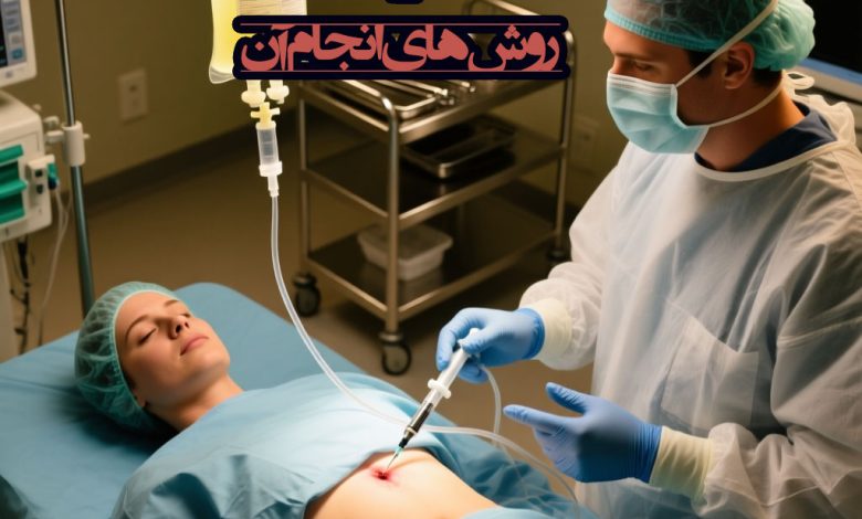 جراحی لیپوساکشن