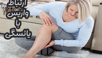 ارتباط واریس و یائسگی