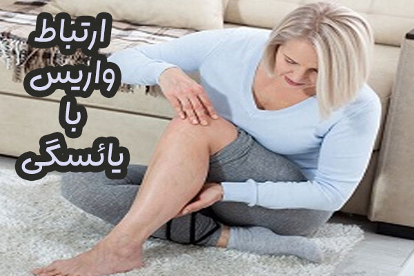 ارتباط واریس و یائسگی