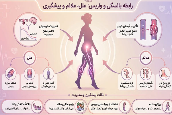 یائسگی و واریس