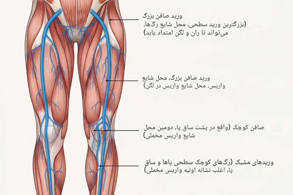 واریس و ترومبوز وریدی