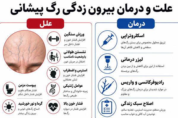 بیرون-زدگی-رگ-پیشانی بیرون زدگی رگ پیشانی
