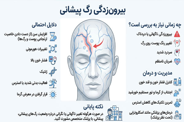 بیرون زدگی رگ پیشانی