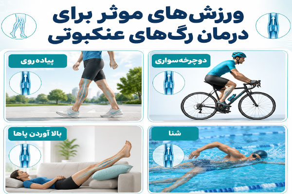ورزش فعالیتهای ورزشی برای درمان رگهای عنکبوتی