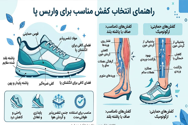 کفش مناسب واریس
