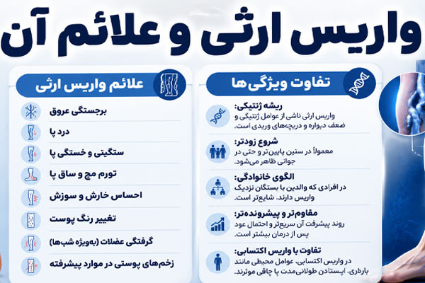 واریس ارثی