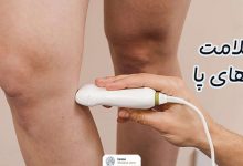 سلامت رگ‌های پا