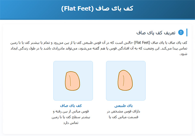 کف پای صاف