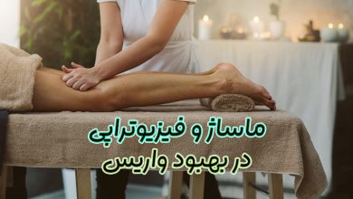 بهبود واریس