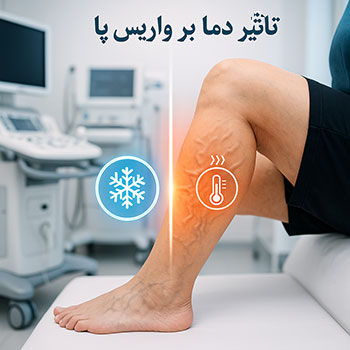 تاثیر دما بر واریس