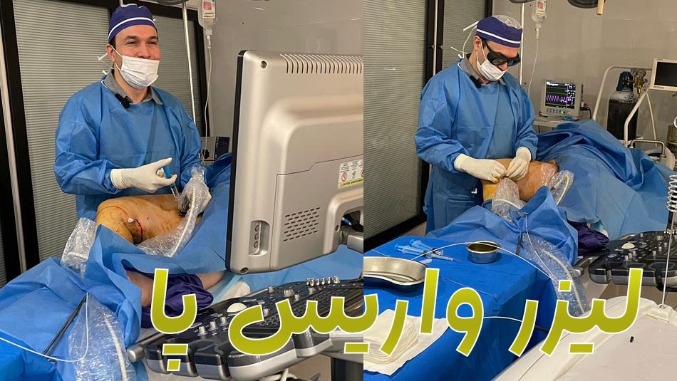 لیزر-واریس-پا